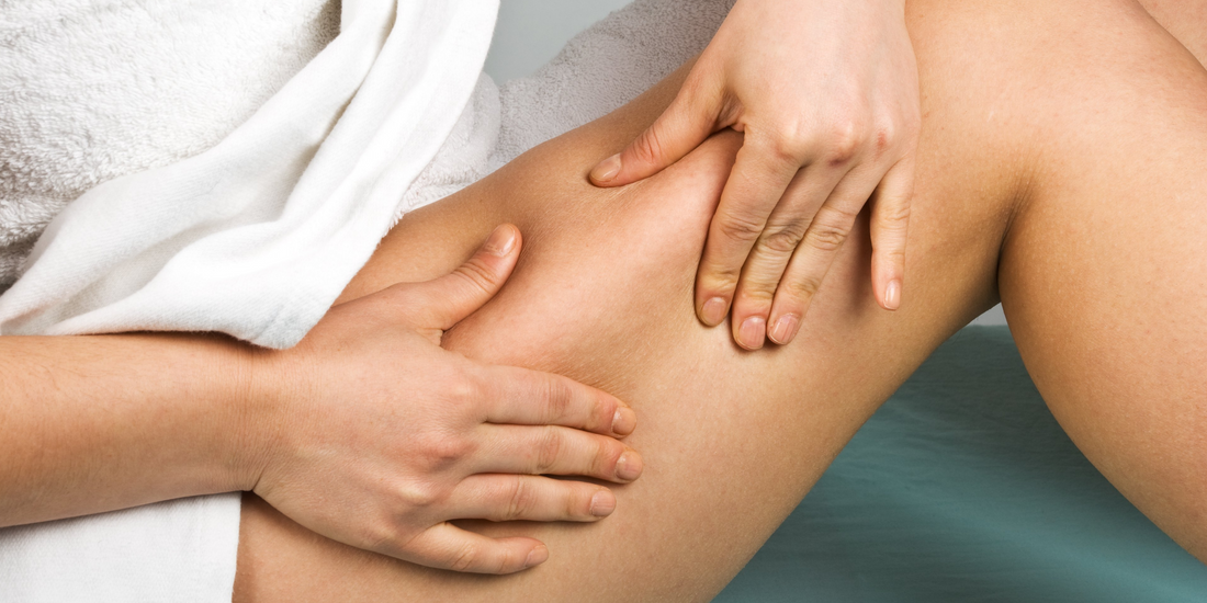 Cellulite during Pregnancy